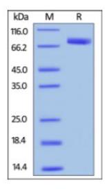 SDS-PAGE (SIRPA-346H).jpg